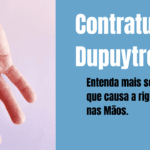 Rigidez em Mãos e Dedos - Contratura de Dupuytren
