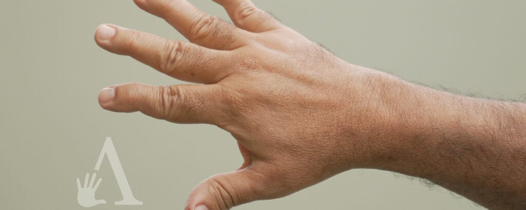 Top 5 profissões que mais causam lesões nas mãos – e como se prevenir