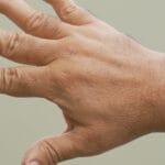 Top 5 profissões que mais causam lesões nas mãos – e como se prevenir